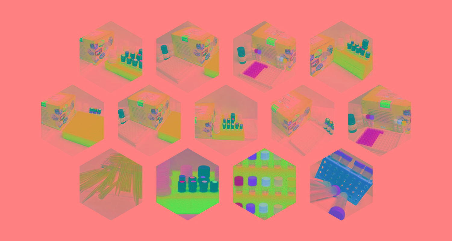 試劑盒|產(chǎn)品檢測(cè)試劑盒|代理品牌