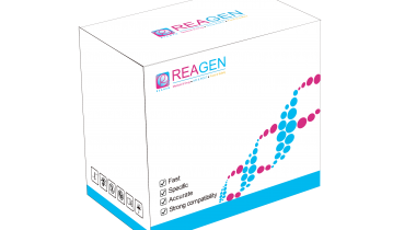 對蝦黃頭病毒（YHV）RNA恒溫核酸檢測試劑盒（不含提?。? />
                            </a>
                        </div>
                                            </div>
                </div>
                <div   id="zn57rpxt3vf"   class="col-lg-5">
                    <div   id="zn57rpxt3vf"   class="product-intro">
                        <h1 class=